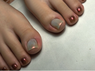 巻き爪専用ジェルデザイン