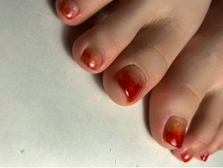 巻き爪専用ジェルデザイン